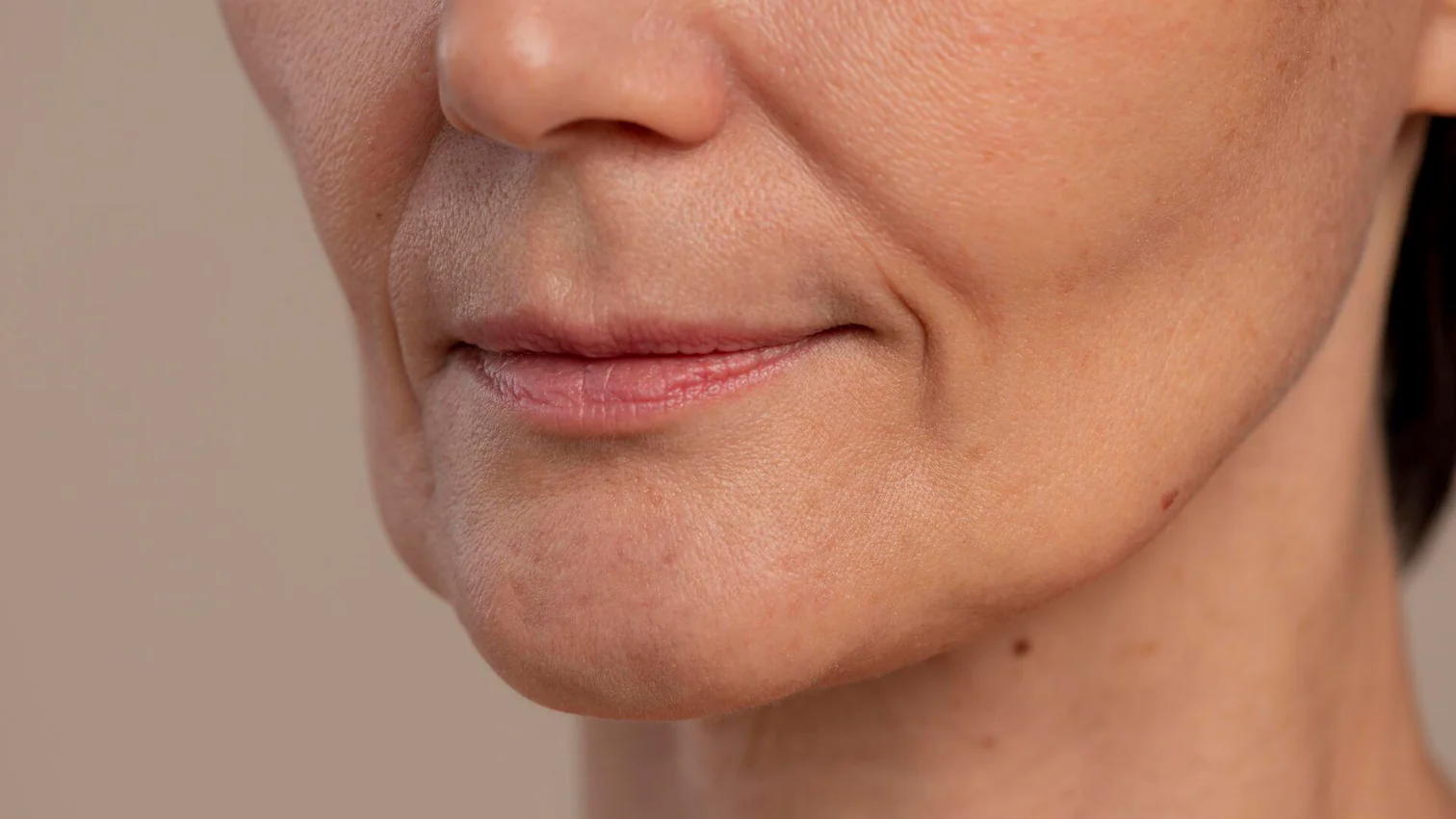 Flacidez facial